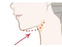 【小顔矯正】二重顎に悩んでいる方へ