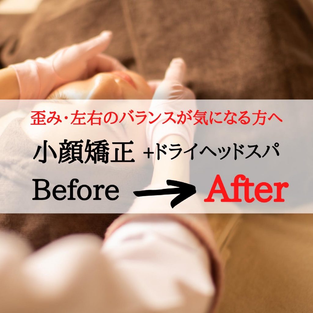 【小顔矯正】Before&After 小顔矯正