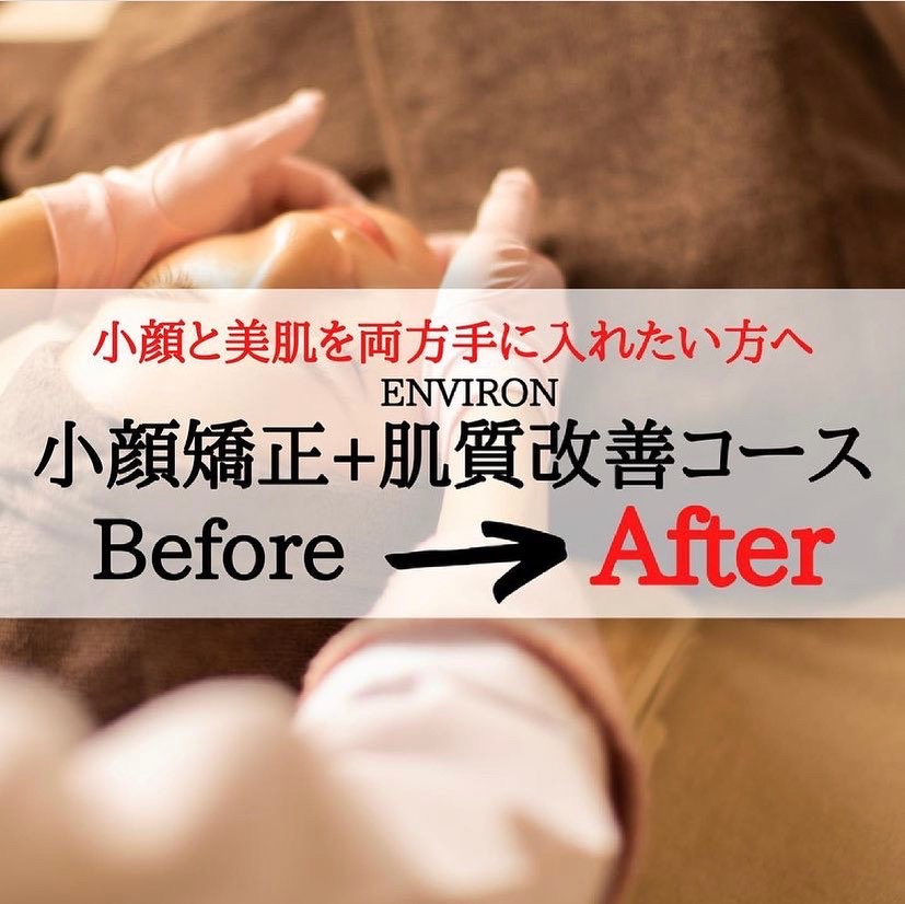 【小顔矯正】Before&After 小顔矯正+ENVIRON肌質改善コース