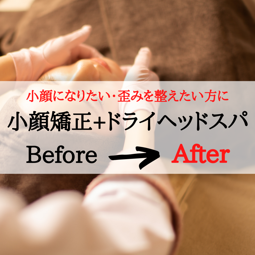 【小顔矯正】男性も小顔の時代！