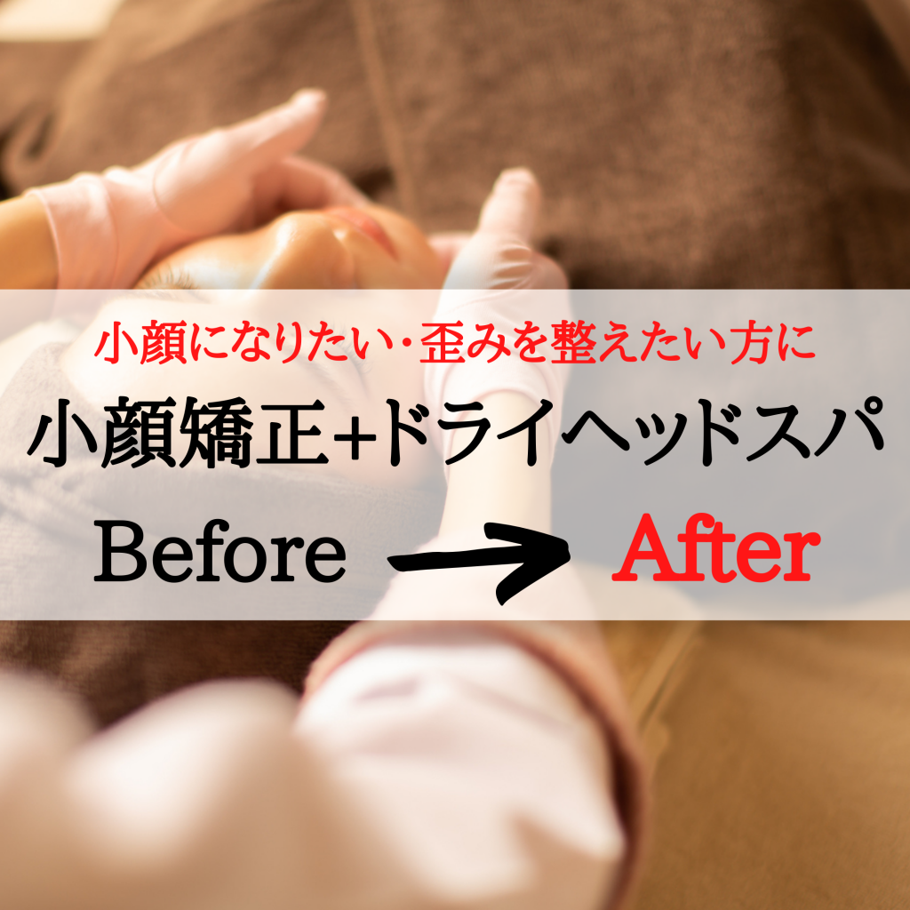 【小顔矯正】Before&After 小顔矯正